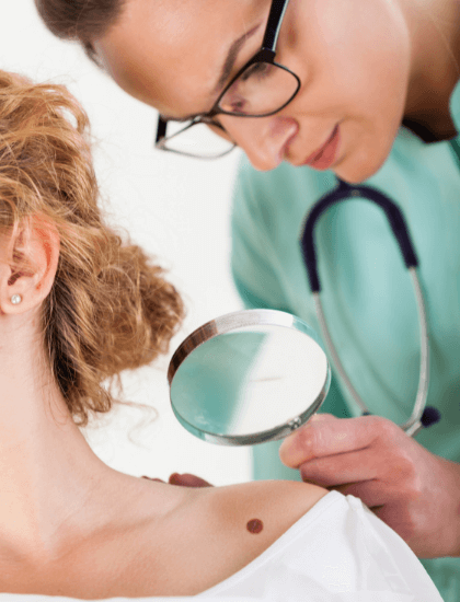 moles diagnosis at truderm adult dermatology